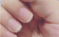 指甲为什么总长进肉里？只因大多数人都做错了这个动作