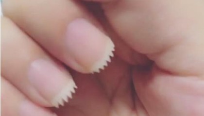 指甲为什么总长进肉里？只因大多数人都做错了这个动作